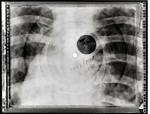 xray5-500x380