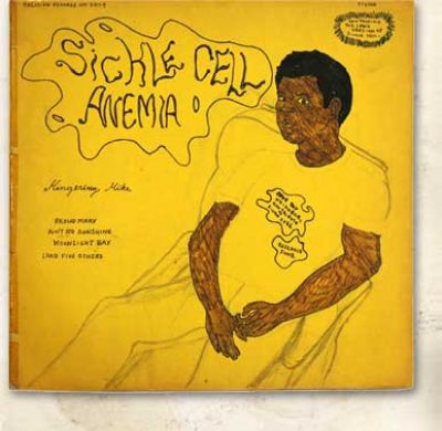 sicklecell