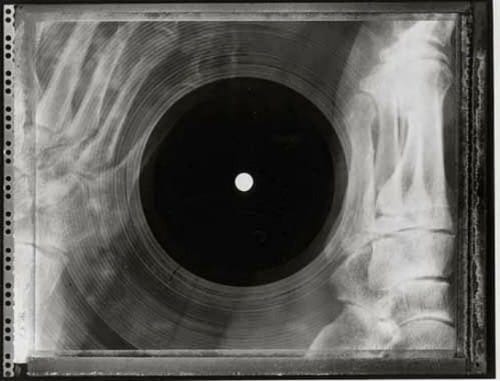 XRayRecord200614