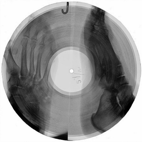 xray4-500x500