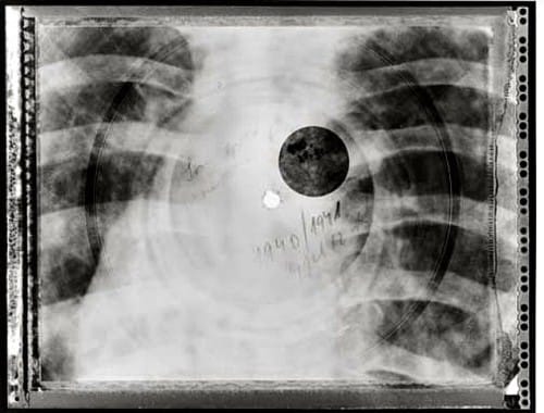 xray5