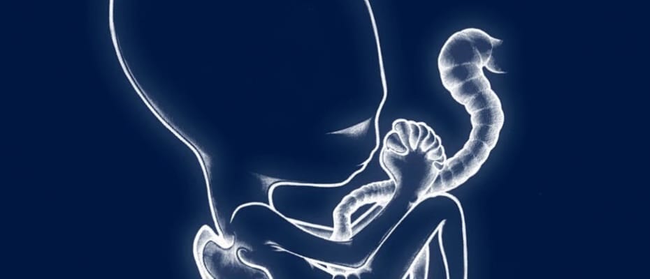 Post-rock - Sigur Ros