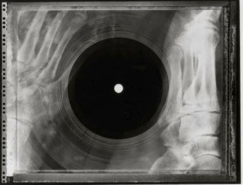 XRayRecord200614-500x381