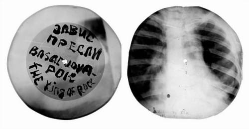 x-ray2